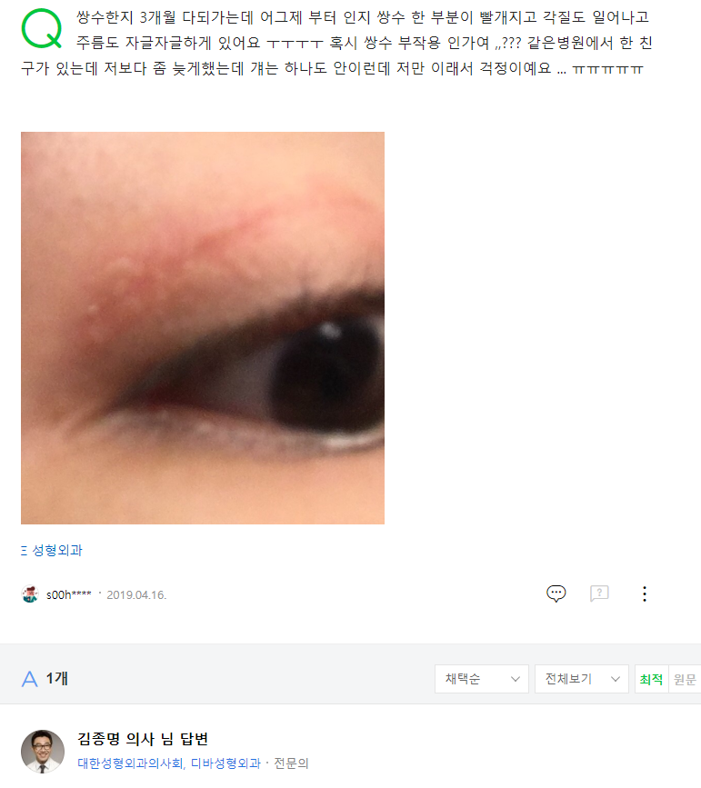 쌍수한지 3개월 다되가는데 네이버 지식인 상담 원문